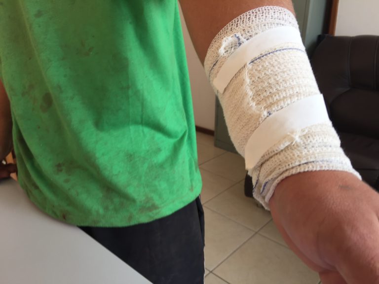 Funcionários da coleta de lixo tem sofrido ferimentos com objetos mal armazenados