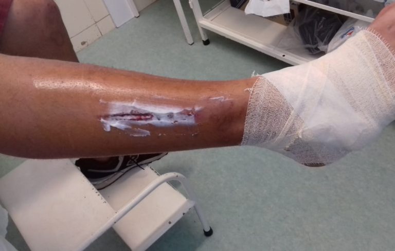 Jovem é ferido na perna por disparo de arma de fogo em São Sepé