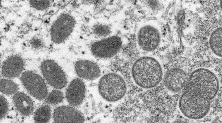 Santa Maria confirma primeiro caso de varíola dos macacos