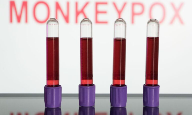 Anvisa autoriza uso emergencial de kits para diagnóstico da varíola dos macacos