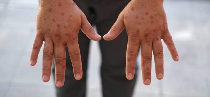 638287632_1527574446034391_9109633091141987629_n